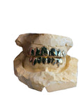 14K YELLOW GOLD GRILLZ SET