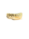 NPG GRILLZ SET DIAMOND CUT