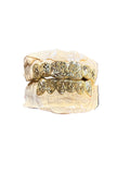 NPG ROSE CUT GRILLZ SET